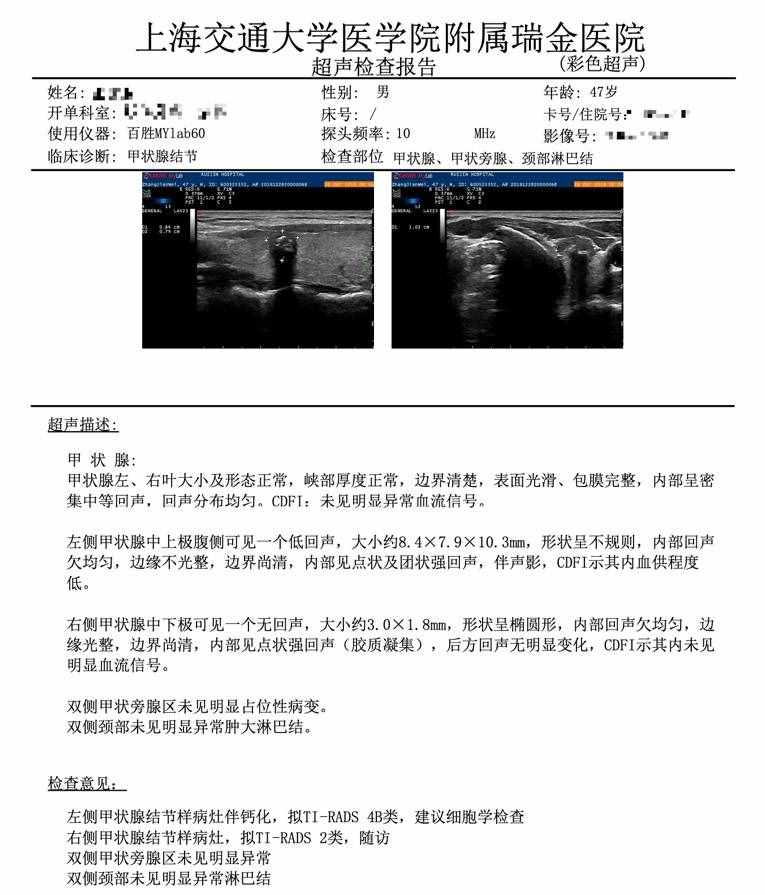 七個問答，全面了解甲狀腺結(jié)節(jié)