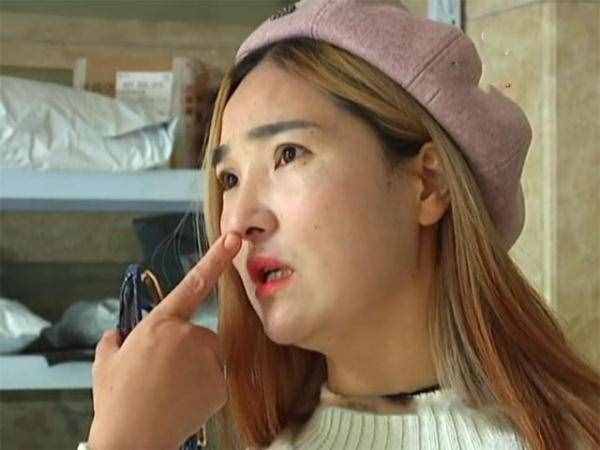 女子花六萬瘦臉，才三個(gè)月就恢復(fù)原狀了，女子：一個(gè)月兩萬？