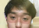 今日更新夏天曬黑了怎么變白（曬黑了怎么快速變白）