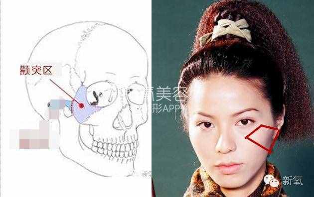 劉濤的高顴骨和劉詩詩的高顴骨是一回事嗎？顴骨高到底怎么辦？