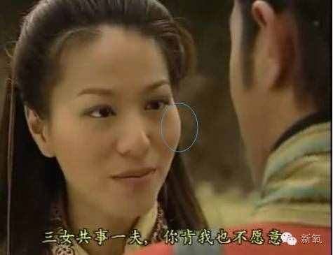 劉濤的高顴骨和劉詩詩的高顴骨是一回事嗎？顴骨高到底怎么辦？