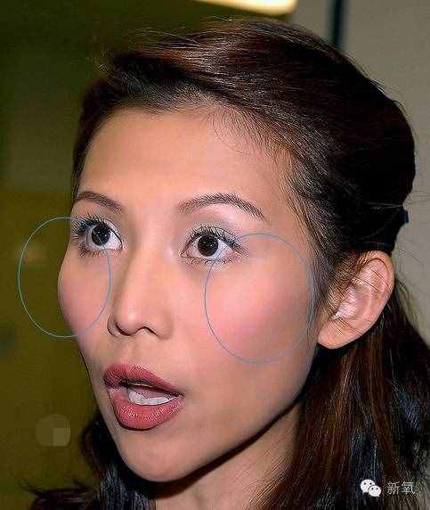 劉濤的高顴骨和劉詩詩的高顴骨是一回事嗎？顴骨高到底怎么辦？