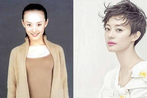 發(fā)際線高怎么辦？