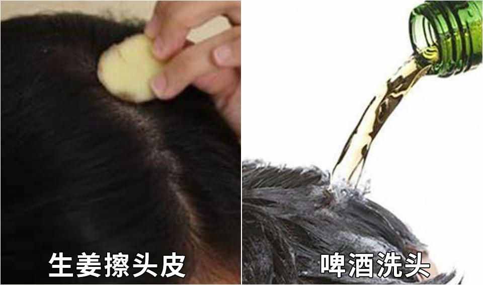 頭發(fā)稀少怎么辦？只要不是脫發(fā)，這8個(gè)方法可用