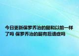 今日更新保羅喬治的腿和以前一樣了嗎 保羅喬治的腿有后遺癥嗎