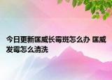 今日更新匡威長(zhǎng)霉斑怎么辦 匡威發(fā)霉怎么清洗