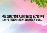 今日更新打籃球大腳拇指頂黑色了指甲可以剪嗎 打籃球大腳拇指頂黑色了怎么辦