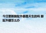 今日更新腳趾外翻是天生的嗎 腳趾外翻怎么辦