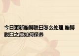 今日更新胳膊脫臼怎么處理 胳膊脫臼之后如何保養(yǎng)