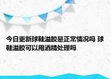 今日更新球鞋溢膠是正常情況嗎 球鞋溢膠可以用酒精處理嗎