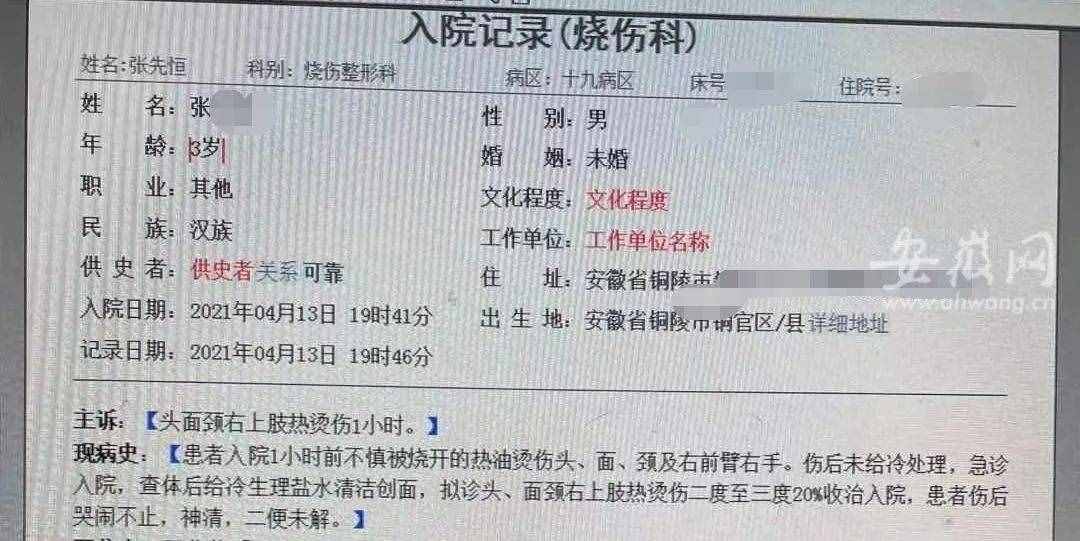 太揪心！一鍋熱油從2歲寶寶頭上澆下，事發(fā)銅陵