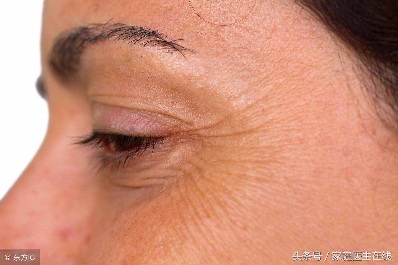 皺紋悄悄爬上眼角？5個(gè)妙招撫平皺紋，年輕十歲！