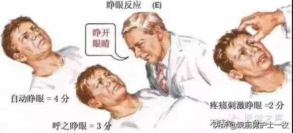 意識障礙病人的評估