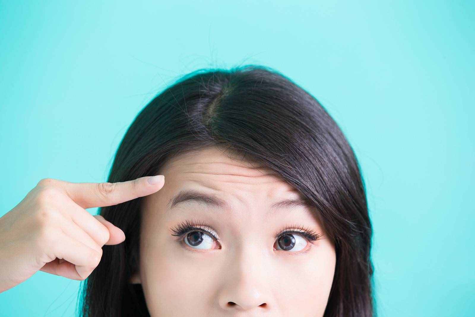 為什么從小就有抬頭紋，眼睛還比別人小？