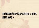 面部脂肪填充恢復(fù)過程圖（面部脂肪填充）
