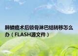 肺鱗癌術(shù)后鎖骨淋巴結(jié)轉(zhuǎn)移怎么辦（FLASH源文件）