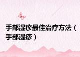 手部濕疹最佳治療方法（手部濕疹）