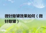 微針除皺效果如何（微針除皺）