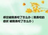 感覺(jué)被跳蚤咬了怎么辦（跳蚤咬的癥狀 被跳蚤咬了怎么辦）