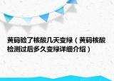 黃碼驗(yàn)了核酸幾天變綠（黃碼核酸檢測過后多久變綠詳細(xì)介紹）