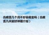 齒痕舌幾個(gè)月不好會(huì)癌變嗎（齒痕舌幾天能好詳細(xì)介紹）