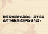 做核酸檢測會流鼻血嗎（鼻子流鼻血可以做核酸檢測嗎詳細(xì)介紹）