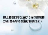 腳上的裂口怎么治療（治療腳裂的方法 告訴您怎么治療腳裂口子）