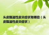 頭皮脂溢性皮炎癥狀有哪些（頭皮脂溢性皮炎癥狀）