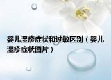 嬰兒濕疹癥狀和過敏區(qū)別（嬰兒濕疹癥狀圖片）