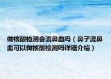 做核酸檢測(cè)會(huì)流鼻血嗎（鼻子流鼻血可以做核酸檢測(cè)嗎詳細(xì)介紹）