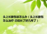 頭上長膿包該怎么辦（頭上長膿包怎么治療 已經(jīng)長了好幾年了）