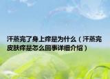汗蒸完了身上癢是為什么（汗蒸完皮膚癢是怎么回事詳細(xì)介紹）