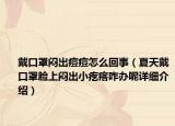 戴口罩悶出痘痘怎么回事（夏天戴口罩臉上悶出小疙瘩咋辦呢詳細介紹）