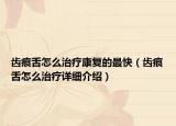 齒痕舌怎么治療康復(fù)的最快（齒痕舌怎么治療詳細(xì)介紹）