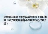 皮膚戴口罩起了密密麻麻小疙瘩（戴口罩臉上起了密密麻麻的小疙瘩怎么辦詳細(xì)介紹）