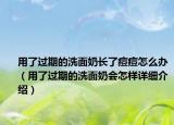用了過期的洗面奶長了痘痘怎么辦（用了過期的洗面奶會怎樣詳細介紹）