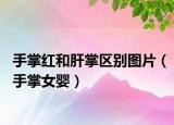 手掌紅和肝掌區(qū)別圖片（手掌女?huà)耄? /></span></a>
                        <h2><a  title=