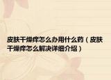 皮膚干燥癢怎么辦用什么藥（皮膚干燥癢怎么解決詳細介紹）