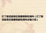 打了新冠疫苗后需要核酸檢測嗎（打了新冠疫苗還需要核酸檢測嗎詳細介紹）
