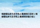 核酸做完多久在手機(jī)上看得到已采樣（核酸做完多久在手機(jī)上看得到詳細(xì)介紹）