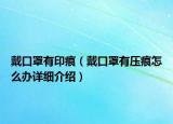 戴口罩有印痕（戴口罩有壓痕怎么辦詳細(xì)介紹）