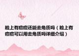 臉上有痘痘還能去角質(zhì)嗎（臉上有痘痘可以用去角質(zhì)嗎詳細(xì)介紹）