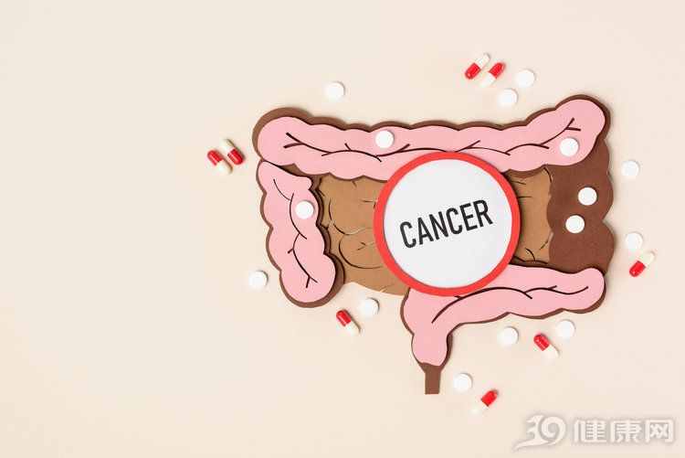 得了大腸癌，身體有哪些癥狀？2個信號，很多人沒看清