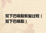 雙下巴吸脂恢復(fù)過程（雙下巴吸脂）