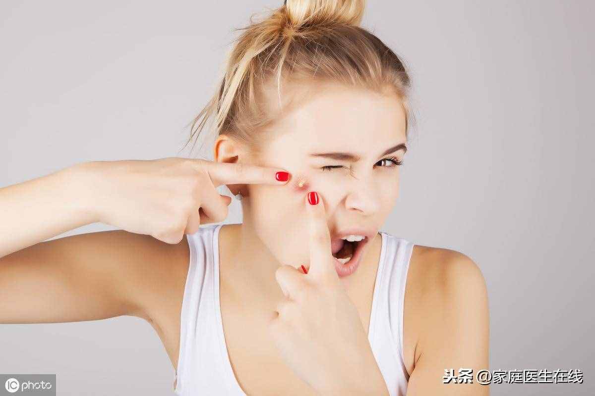 如何能“消滅”青春痘？皮膚專家教你幾招，讓你“戰(zhàn)痘”到底