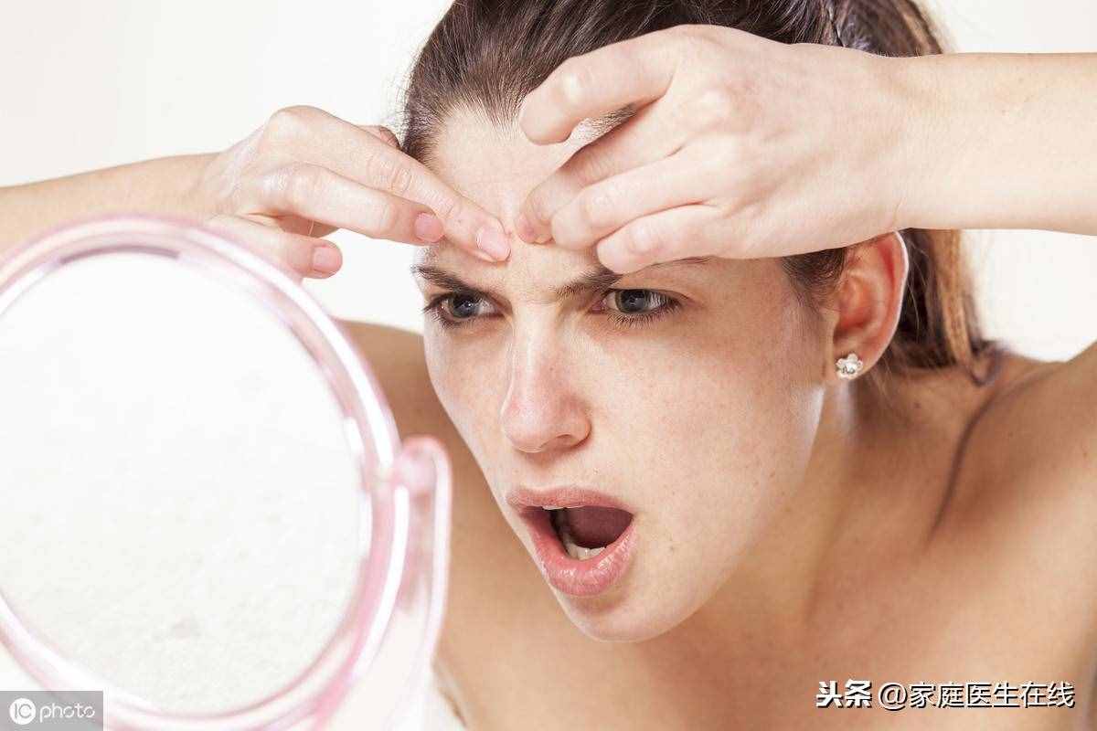 如何能“消滅”青春痘？皮膚專家教你幾招，讓你“戰(zhàn)痘”到底