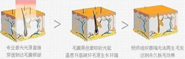 一根棉線擔(dān)當(dāng)?shù)拿撁吧衿鳌保?class=