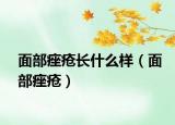 面部痤瘡長(zhǎng)什么樣（面部痤瘡）