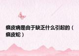 癩皮病是由于缺乏什么引起的（癩皮蛇）