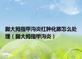腳大拇指甲溝炎紅腫化膿怎么處理（腳大拇指甲溝炎）